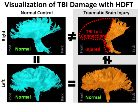 Visualization of TBI Damage with HDFT