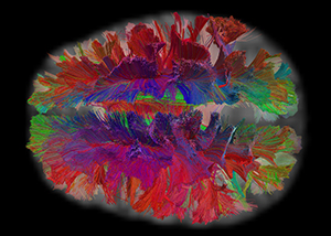 image of a brain scan