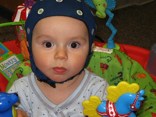 child with EEG cap